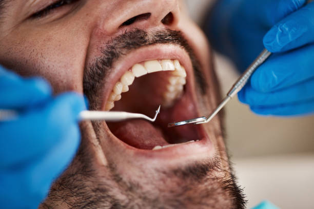 Best Holiday Emergency Dentist in Monte Sereno, CA